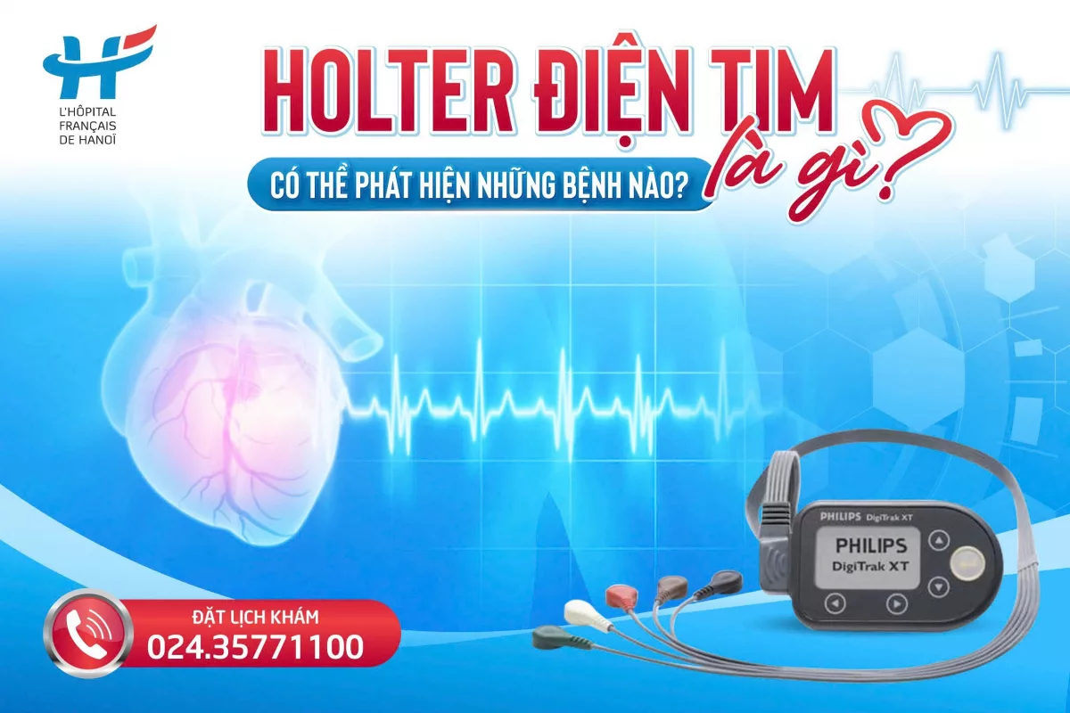 HOLTER ĐIỆN TIM ĐƯỢC CHỈ ĐỊNH KHI NÀO?